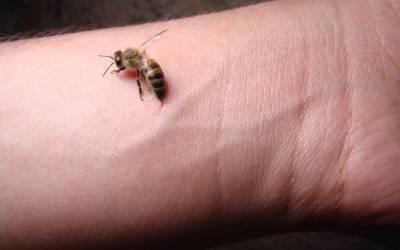 a close-up of a bee with its stinger in a person's arm